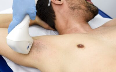 Qual é o método de depilação mais eficaz para os homens?