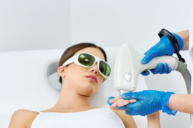 tipos de depilacao a laser