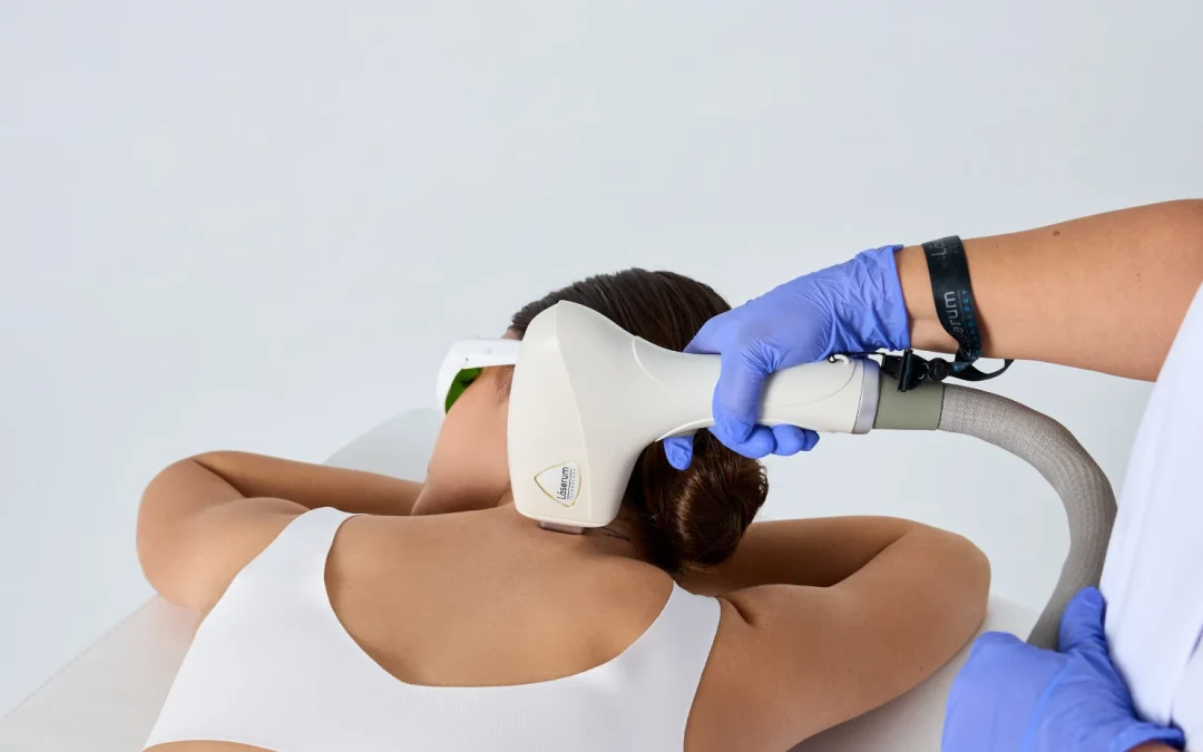 Depilação a laser: como funciona?
