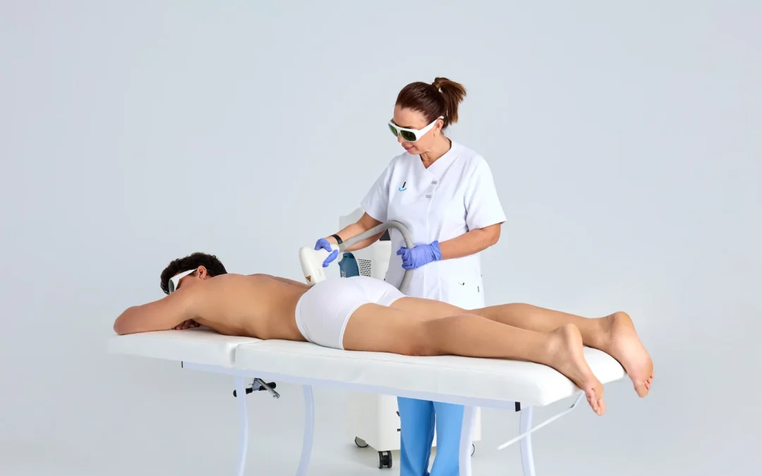 Depilação a laser perianal: O que é, e como é feita?