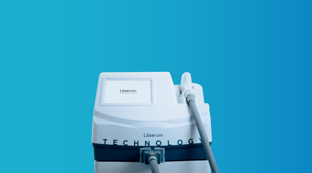 Diferenças entre o laser SHR e o laser díodo