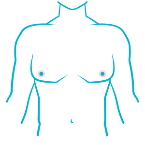 areolas homem
