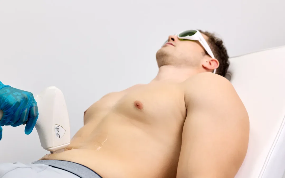 Depilação a laser nos testículos: tem riscos?