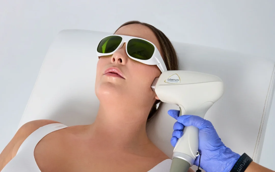 Eliminação duradoura de pelos faciais em mulheres