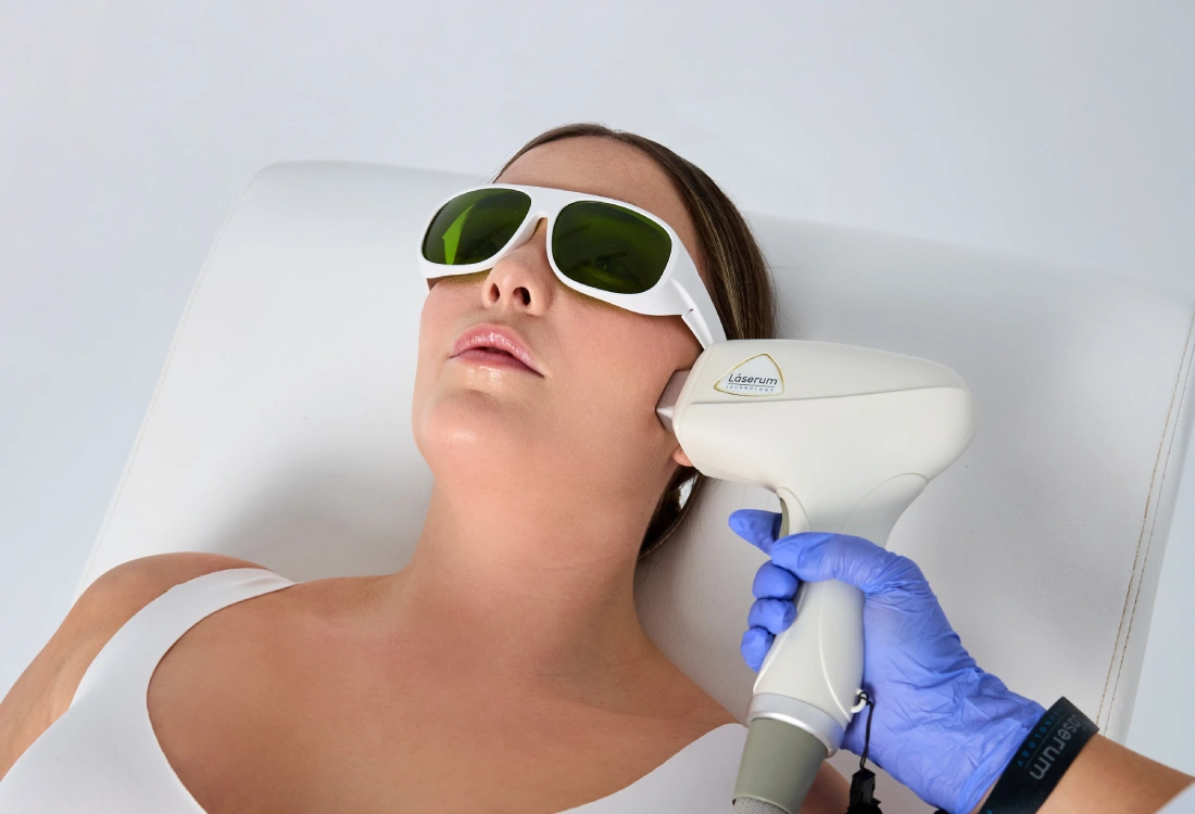 Eliminação duradoura de pelos faciais em mulheres
