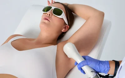 Vantagens e desvantagens da depilação com cera fria